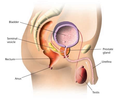 Prostate Cancer Surgery Advanced Urology Institute