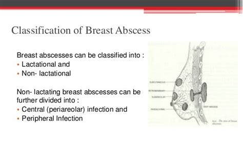 Breast Abscess