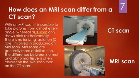 Image Result For Difference Between Mri And Cat Scan Cat Scan Mri