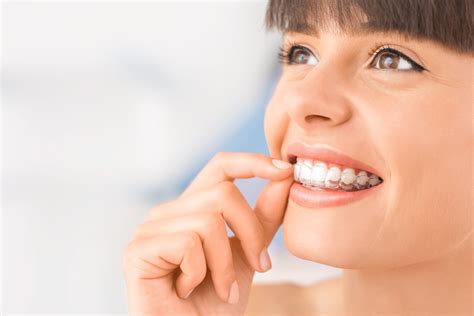 Invisalign Treatment Frequently Asked Questions Dental On Clarendon