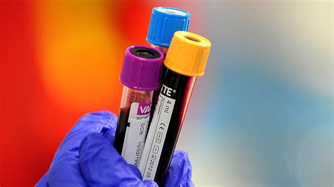 Blood Test Could Help To Detect Lung Cancer Early Bt