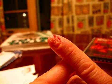 Nail growth isn't as simple as you'd expect. Soul Amp: Fingernail finally came off...Photo of smashed ...