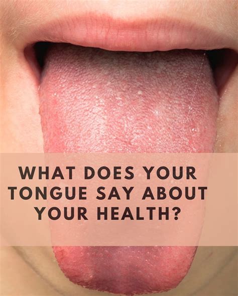 Vīdl Wellness On Instagram “what Does Your Tongue Say About Your Health Since Ancient Times