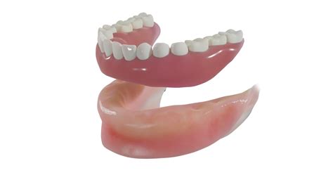 Custom Dentures And Partial Dentures Stone Ranch Dental Group