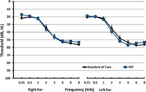 Average Hearing Thresholds For Left And Right Ears For Trt And Sc