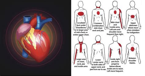 7 Warning Signs Of An Imminent Heart Attack That Women Shouldnt Ignore Daily Health Post