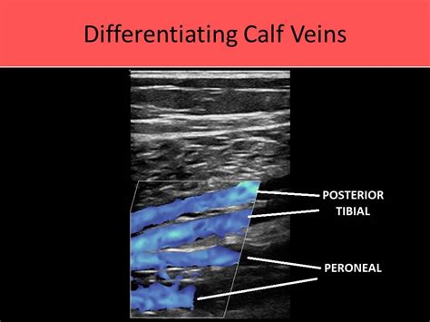 Calf Veins Anatomy
