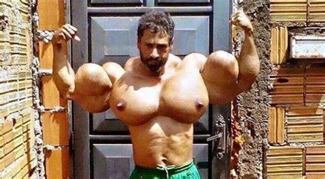Bodybuilder Blows Arms Out With Oil Injections