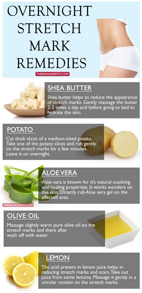 Home Remedies To Remove Stretch Marks Overnight Infographic