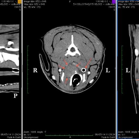 Ct Scan Images From Left To Right Sagittal Transverse And Dorsal