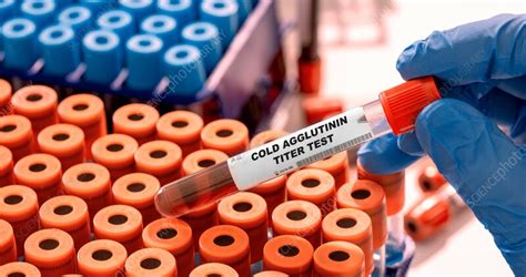 Cold Agglutinin Titre Blood Test Conceptual Image Stock Image F036