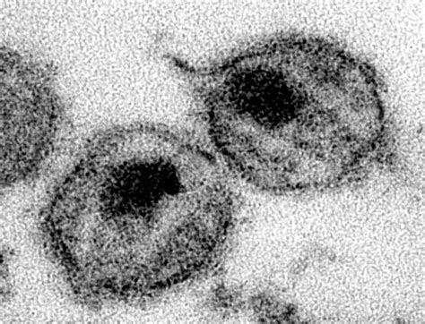 Free Picture Ultrastructural Details Human Immunodeficiency Virus