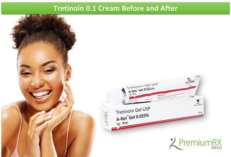 Tretinoin 01 Cream Before And After Premiumrx Online Pharmacy