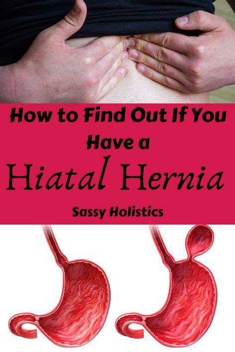 9 Natural Treatments Ideas Hiatus Hernia Hiatal Hernia Diet Hernia