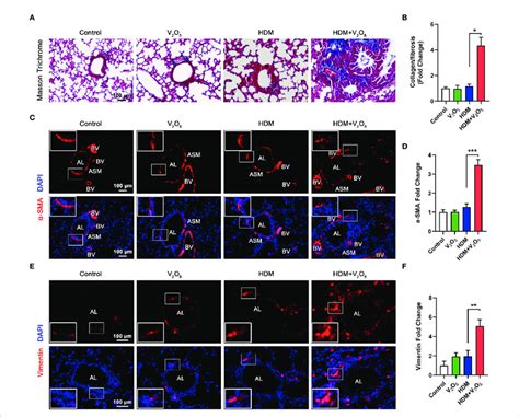 V 2 O 5 Co Exposure Aggravates Hdm Induced Airway Remodeling A