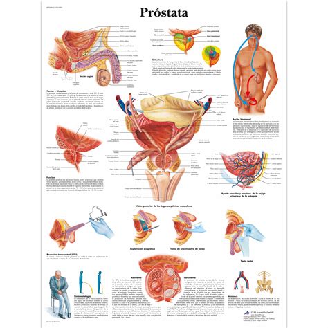 Explains prostate problems including prostatitis and benign prostatic hyperplasia. Próstata - 1001895 - 3B Scientific - VR3528L - Urinary ...