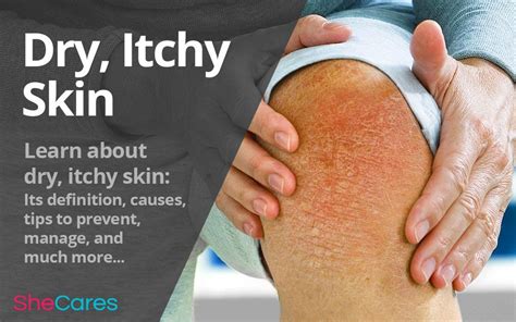 Dealing With Dry Itchy Skin Is Never Fun But Learning More About It