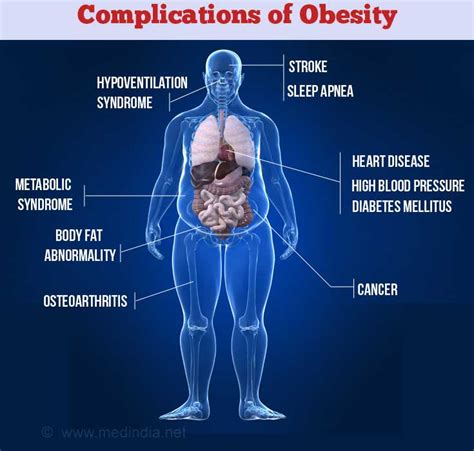 Obesity Causes Symptoms Diagnosis Complications Treatment