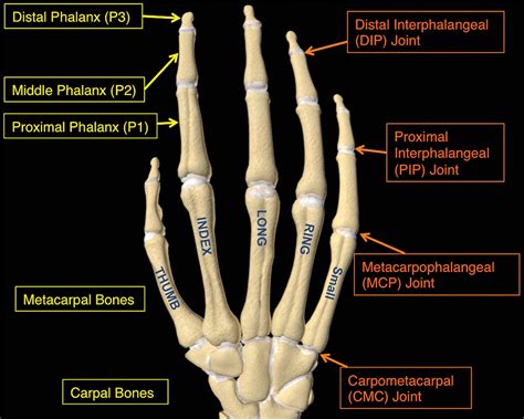Traumatic Finger Injuries What The Orthopedic Surgeon Wants To Know Radiographics