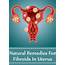 6 Best Natural Cures For Fibroids In Uterus  How To Cure
