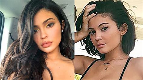 kylie jenner admits she removed her lip filler youtube