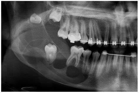 Dentistry Journal Free Full Text Unusual Imaging Features Of