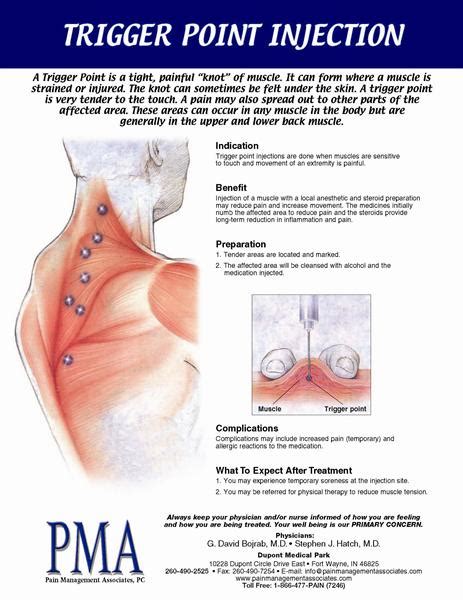 How do you release trigger points in the buttocks and hips? Trigger Point Injection (Read more )