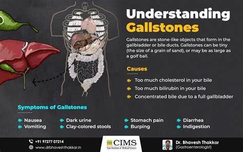 Gallstones Symptoms Causes And Treatment By Best Gastroenterologist