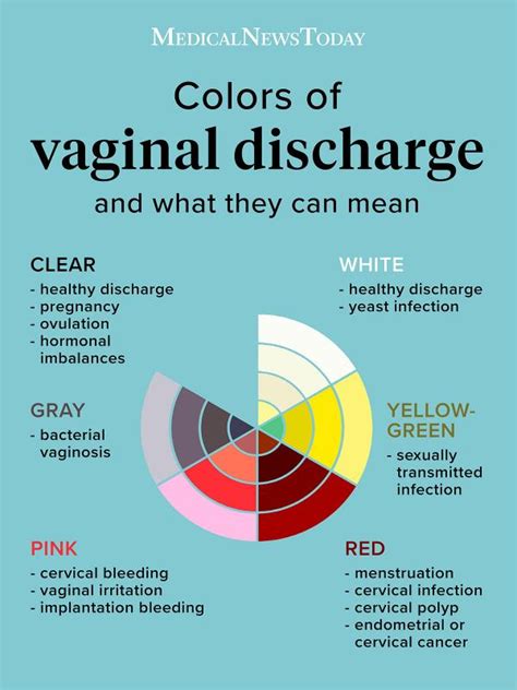 Colours Of Vaginal Discharge Infographic Fabwoman News Style