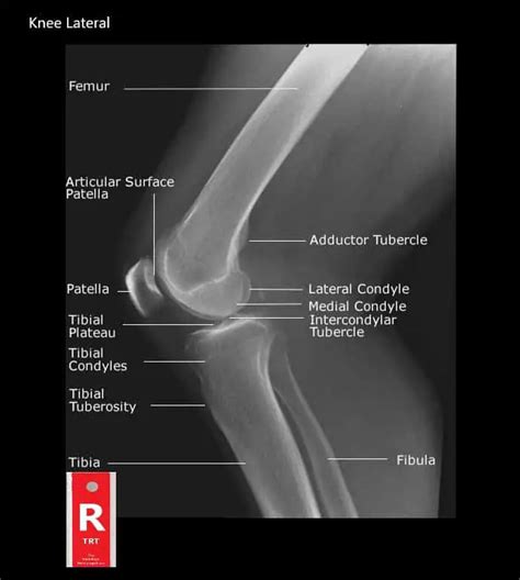 Student Study Guide Knee Anatomy