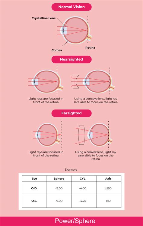 Contact Lens Prescription How To Read And Get It Right