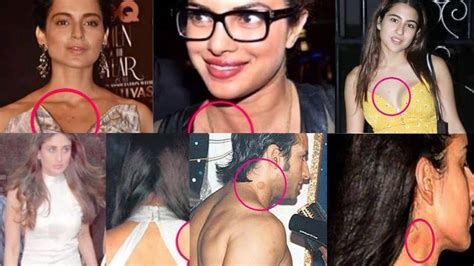Bollywoods Love Bite Revelations Celebs Who Wore Their Affection