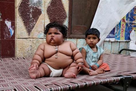 Morbidly Obese Baby Leaves Doctors Baffled Tipping The Scales At Nearly