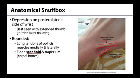 Anatomical Snuffbox M1 Learning Objectives Youtube