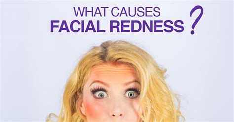 Facial Redness Read More About Some Possible Reasons And Treatments