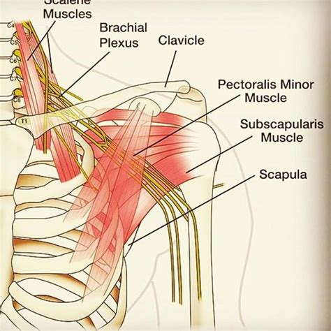 Anatomy The Brachial Plexus Plexus Products Brachial Medical History