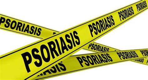 Psoriasi, tiroide, emicrania e microcisti. La ...