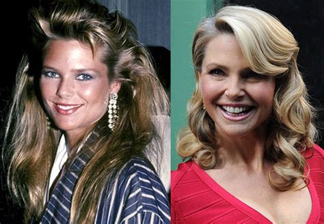 Christie Brinkley Before And After Plastic Surgery