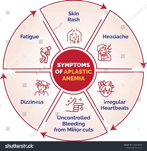 Aplastic Anemia Skin Rash Headache Fatigue Stock Vector Royalty Free