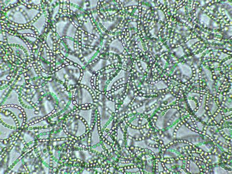 Nostoc Sp Algae Under Microscopic View Genus Of Cyanobacteria Found