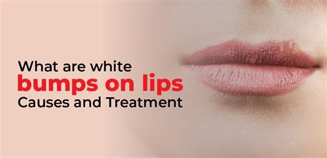 What Are White Bumps On Lips Causes And Treatment Health Maintain