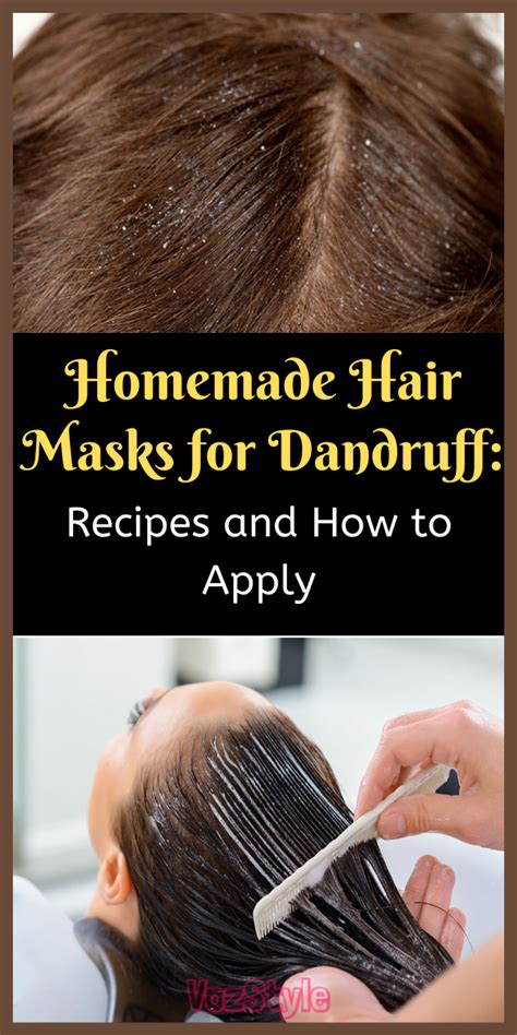 Hair Mask Can Play A Vital Role In Treating Dandruff You Know Getting Rid Of Dandruff Ca In