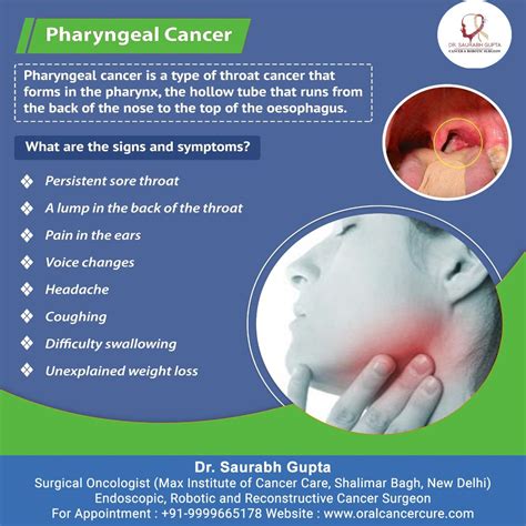 Dr Saurabh Gupta Oncologist Signs And Symptoms Of Pharyngeal Cancer