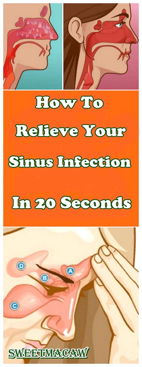 How To Relieve Your Sinus Infection In 20 Seconds Sinus Infection