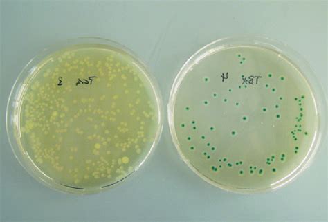 Aerobic Mesophilic Bacteria From A Water Sample That Have Formed