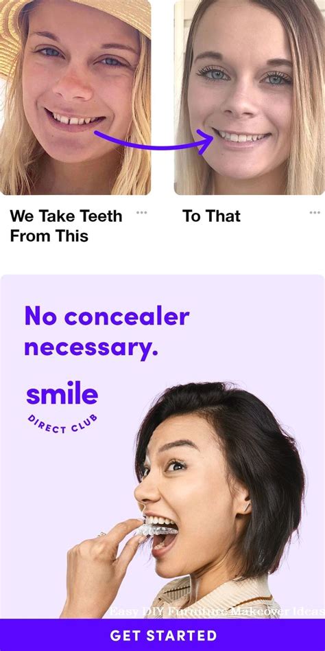 How To Straighten Your Teeth Yourself A Guide To Diy Methods Super