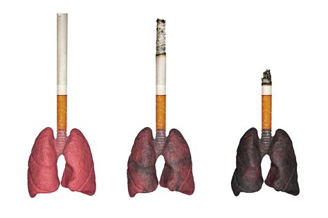 How To Help Lungs Recover After Quitting Smoking