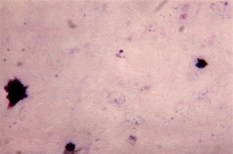 Free Picture Micrograph Plasmodium Malariae Microgametocyte