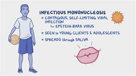 Infectious Mononucleosis Nursing Osmosis Video Library