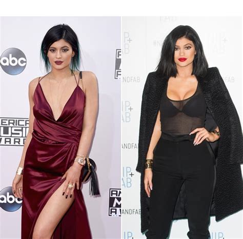 Kylie Jenner Breast Implants Plastic Surgeons Weigh In Hollywood Life